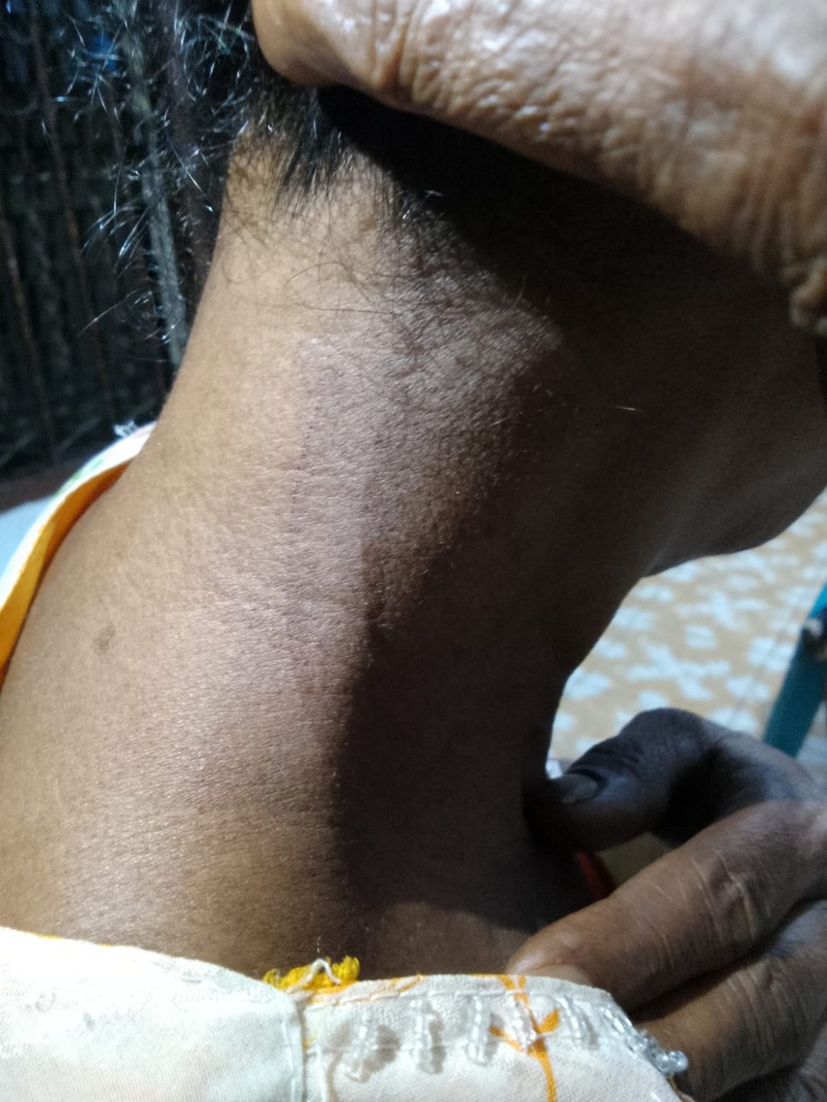 Diduga Tidak Sesuai Dengan Fakta ,Lain Kronologi Lain Pula Yang Diberitakan Oleh Media