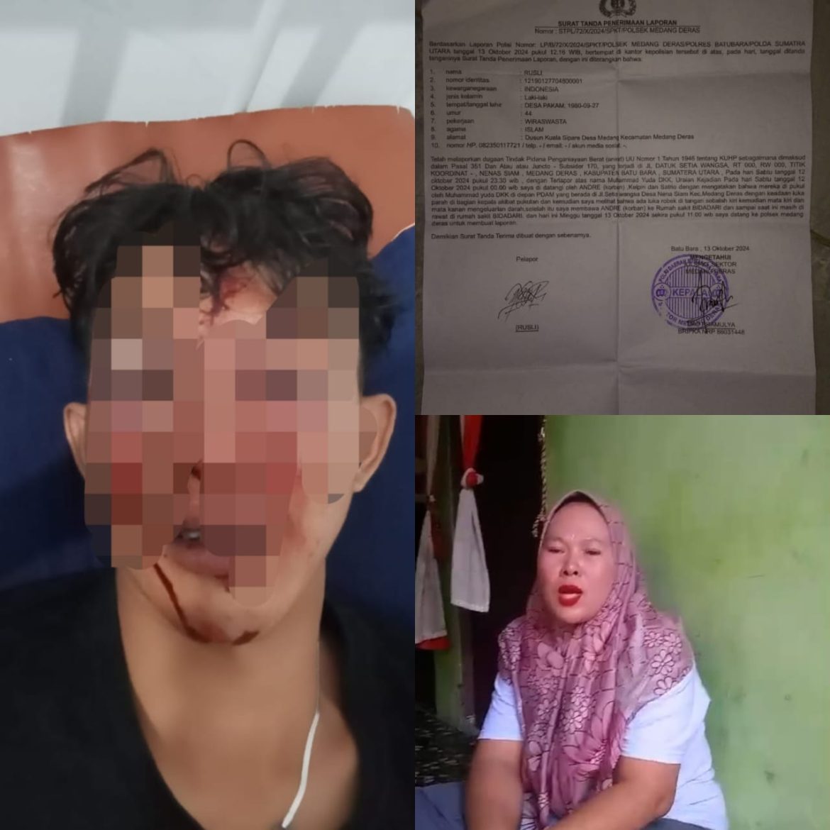 12 Terduga Pelaku Penganiayaan masih Bebas Berkeliaran, Pihak Pelapor Menyangkan lamban nya kinerja kepolisian Polsek Medang Deras.