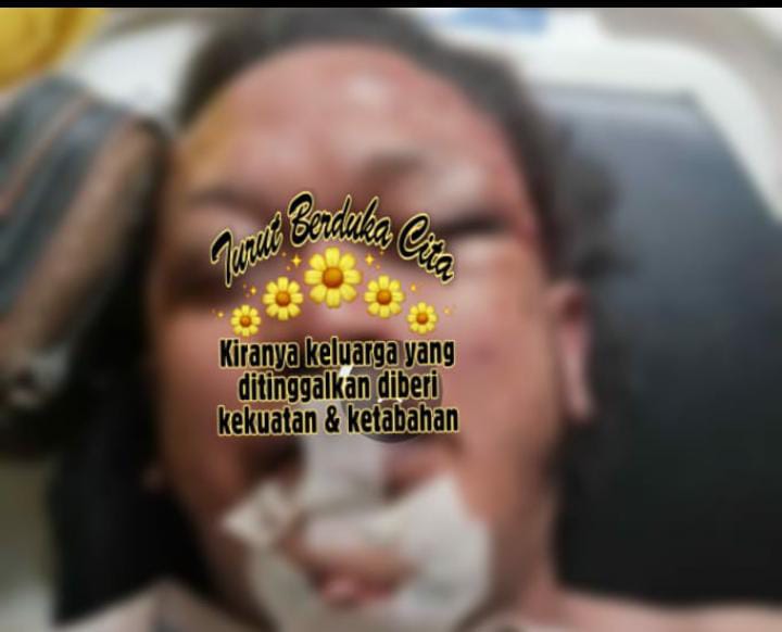 Sudah Seminggu Pasca Tewasnya Wartawan Nico di Medan, Masih Menjadi Misteri!!